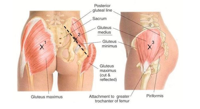 Iliotibial tract bursa - Pocket Anatomy