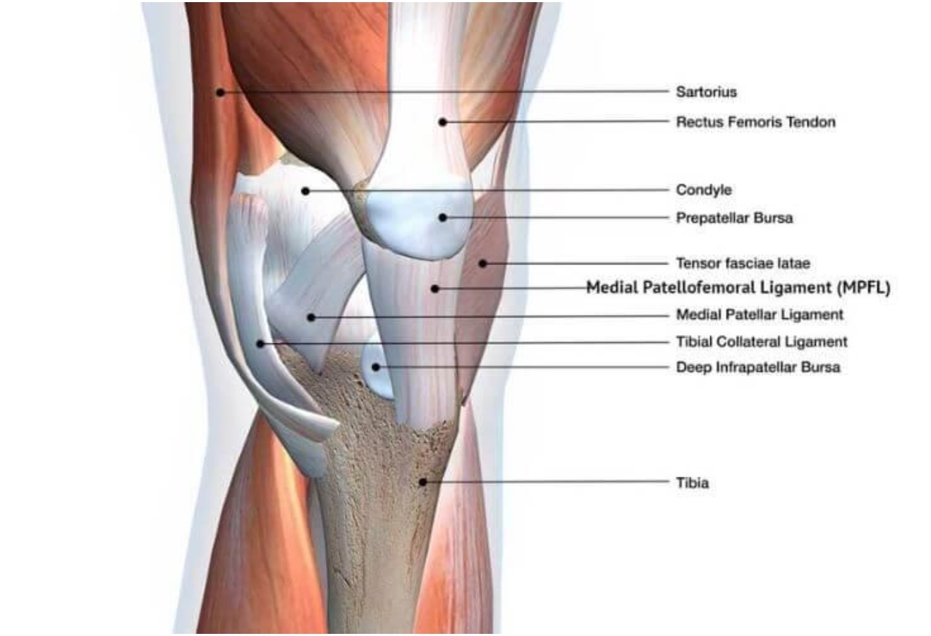 MEDIAL PATELLOFEMORAL LIGAMENT MPFL RECONSTRUCTION SURGERY Midwest 