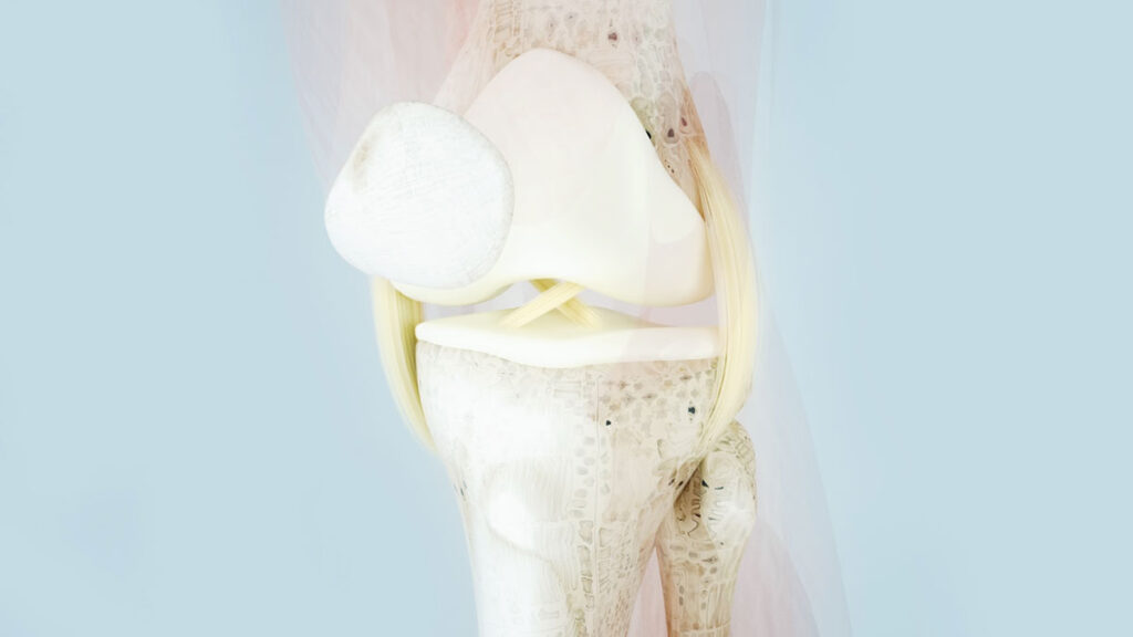 Patella Tendon Repair Midwest Orthopaedics